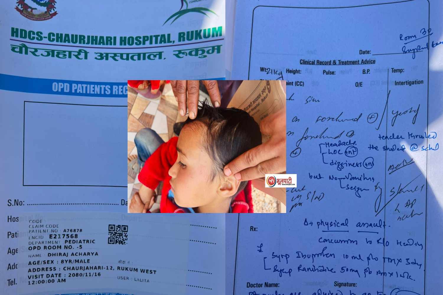 चौरजहारीमा शिक्षकको कुटाईबाट बिद्यार्थी घाईते