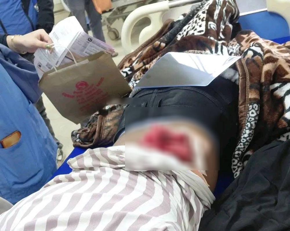 जाजरकोटको कार्कीज्युला मेलामा गोली प्रहार, एक जना घाइते